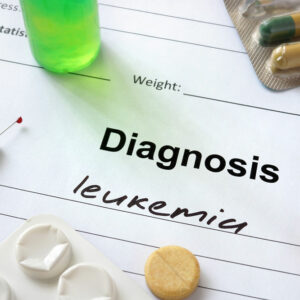 Acute Myeloid Leukemia – Stages, Types, Symptoms, Causes, and Therapies