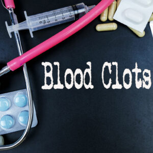 Blood Clotting Disorders – Symptoms, Causes, and More