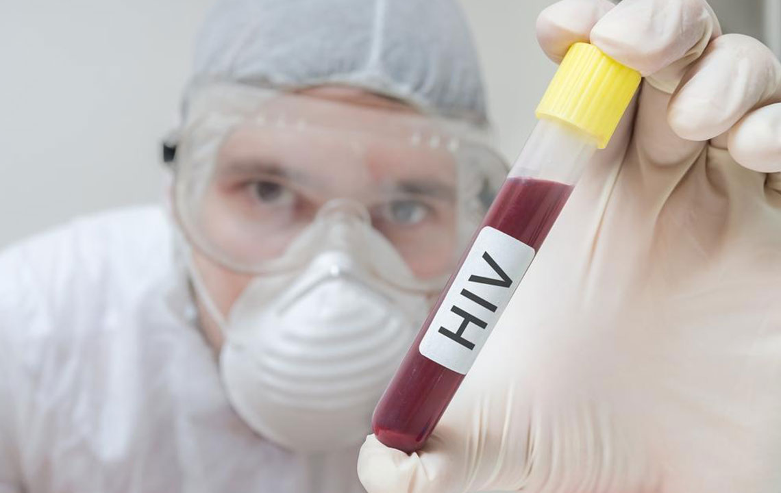 Diagnosis of HIV AIDS – A proper treatment starts with proper diagnosis
