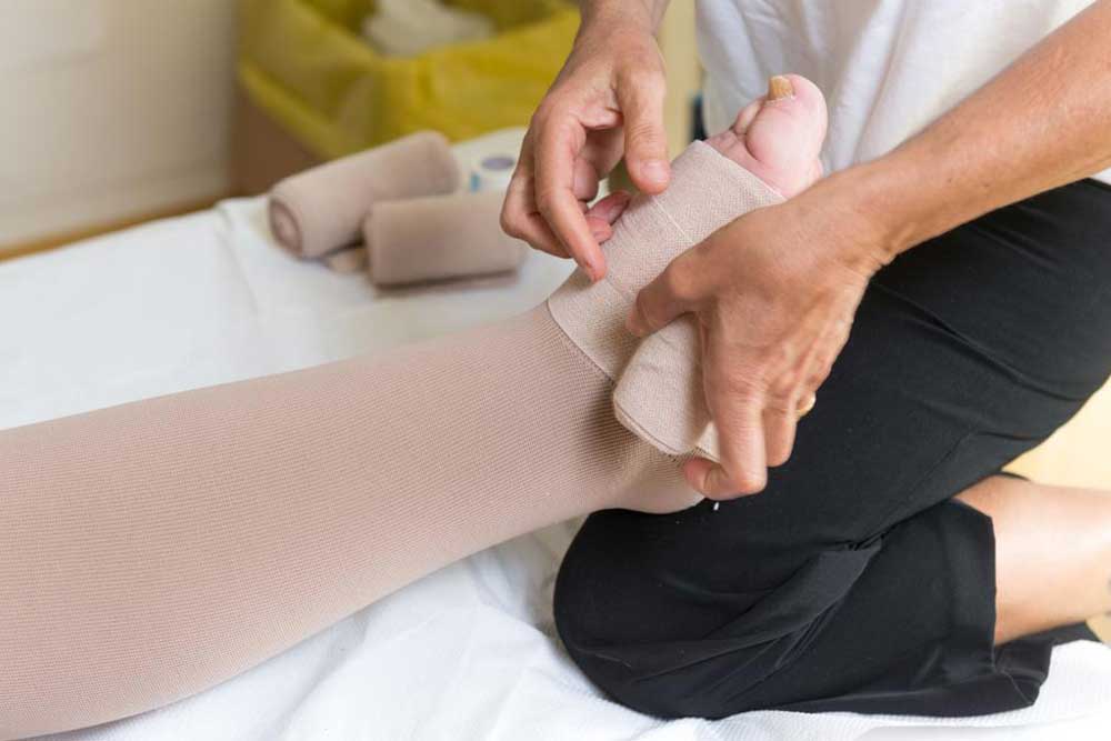 Swollen Legs – Causes and Remedies