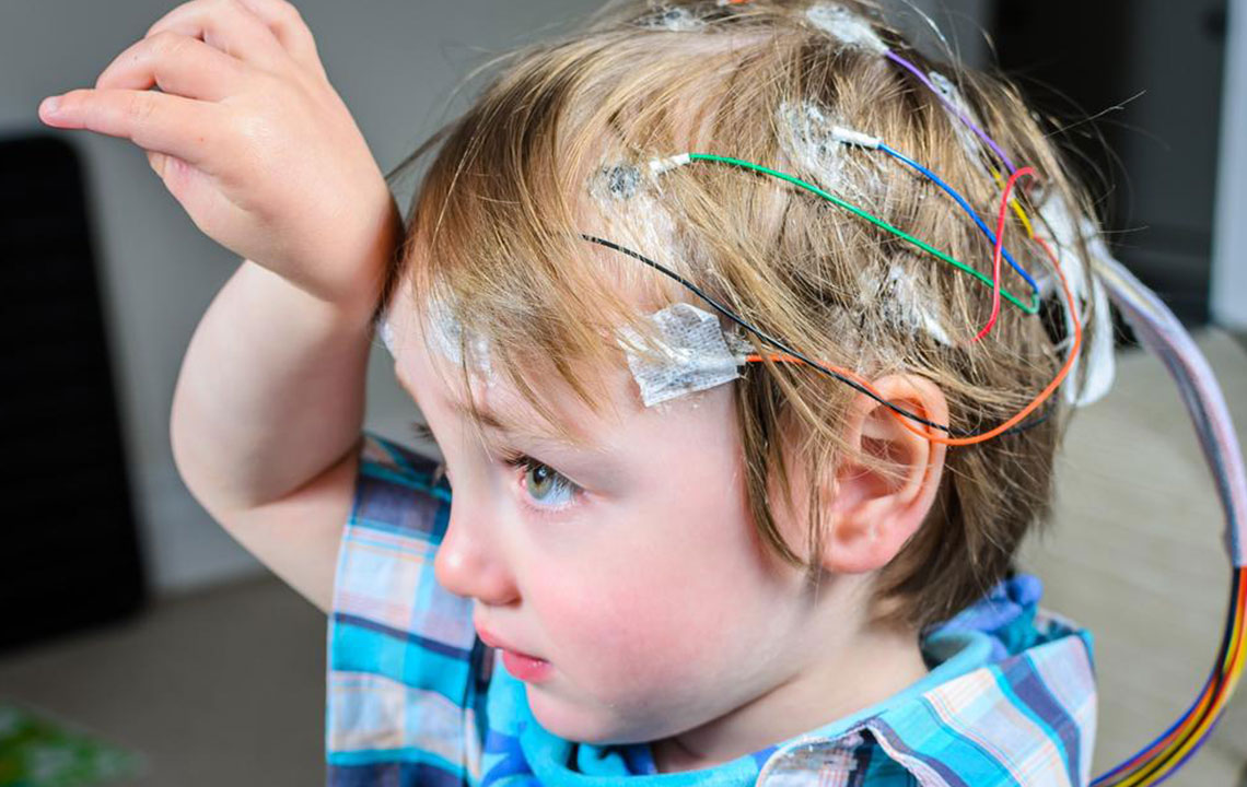 Seizures – Symptoms and Treatment
