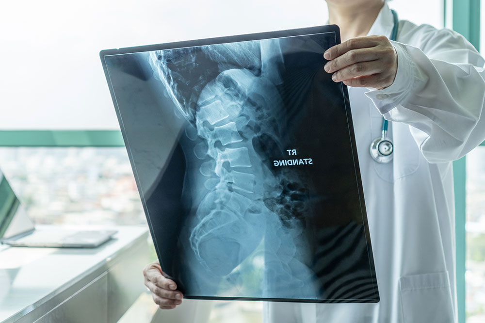 Spinal muscular atrophy – Types and symptoms